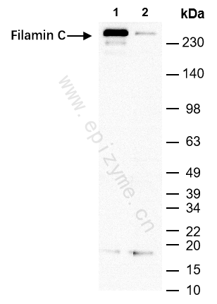 Anti-Filamin C Rabbit mAb [35F73C02]
