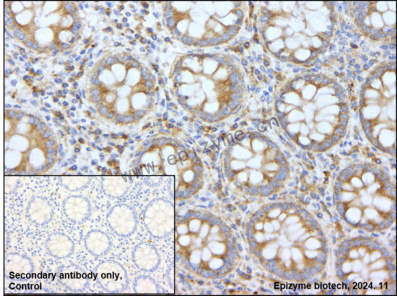 Anti-Filamin C Rabbit mAb [35F73C02]