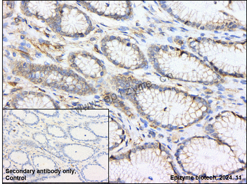 Anti-Filamin C Rabbit mAb [35F73C02]