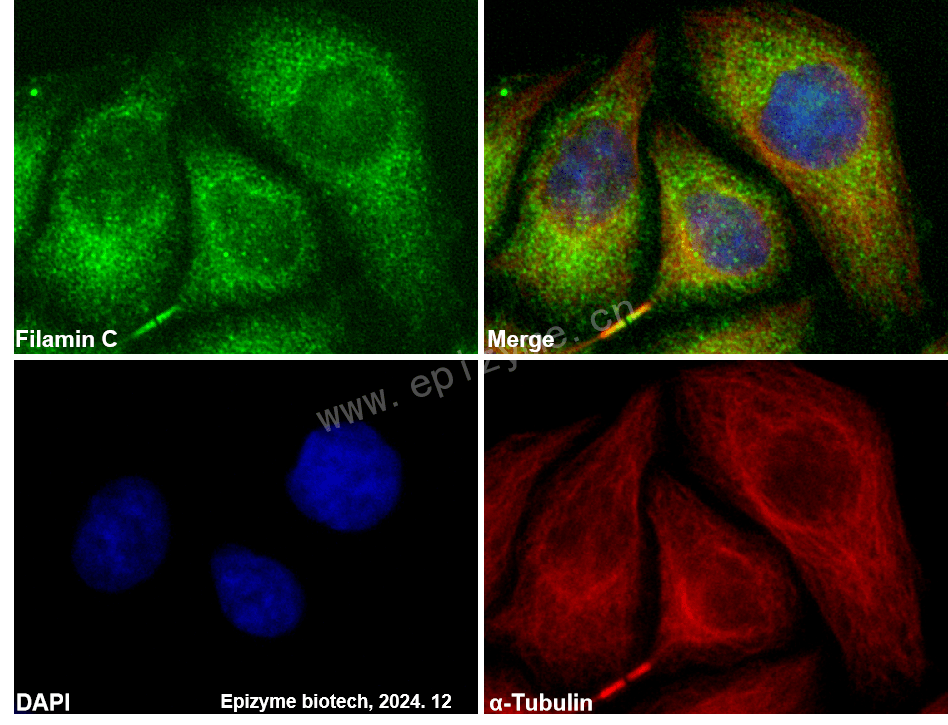 Anti-Filamin C Rabbit mAb [35F73C02]