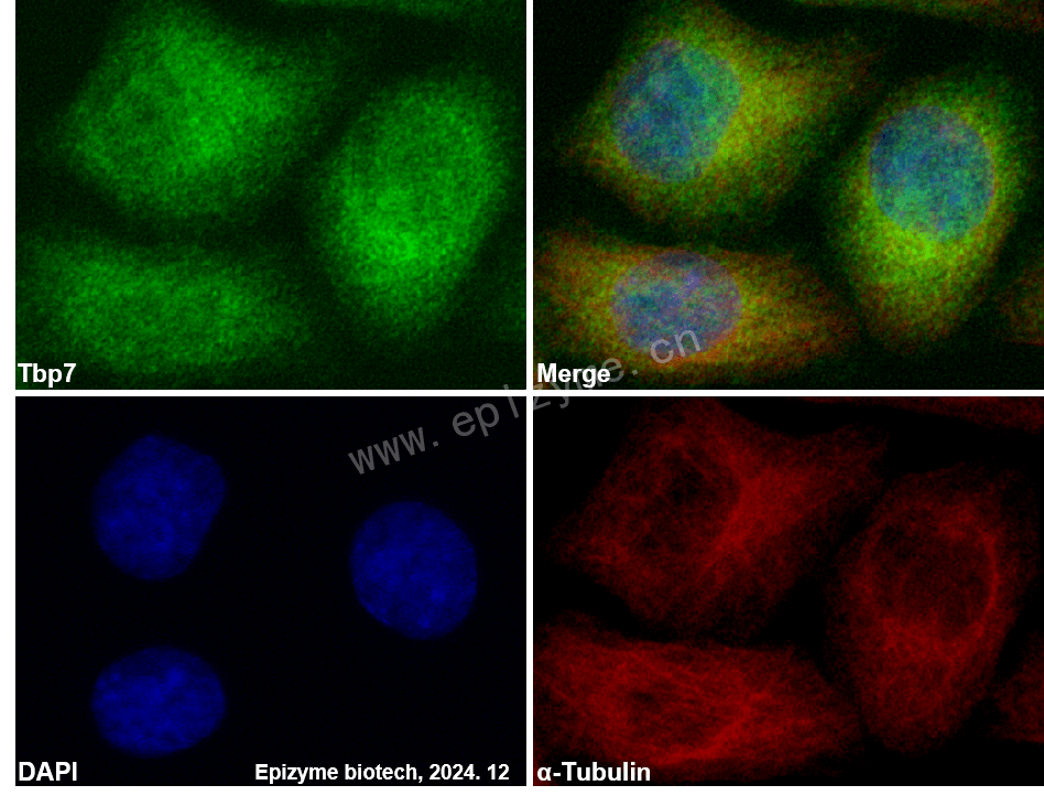 Anti-Tbp7 Rabbit mAb [92L79F02]