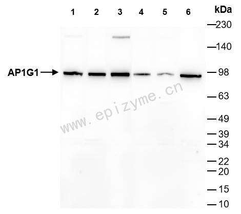 Anti-AP1G1 Rabbit mAb [58K11L45]