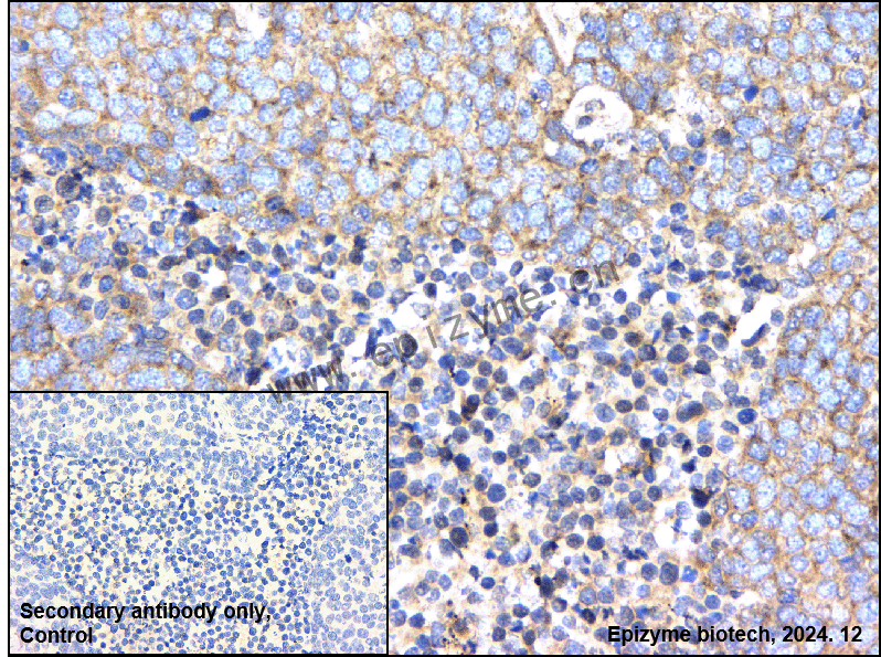 Anti-AP1G1 Rabbit mAb [58K11L45]