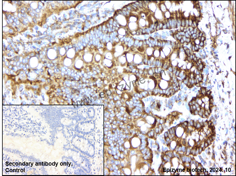 Anti-PUMA Rabbit mAb [95T02C35]