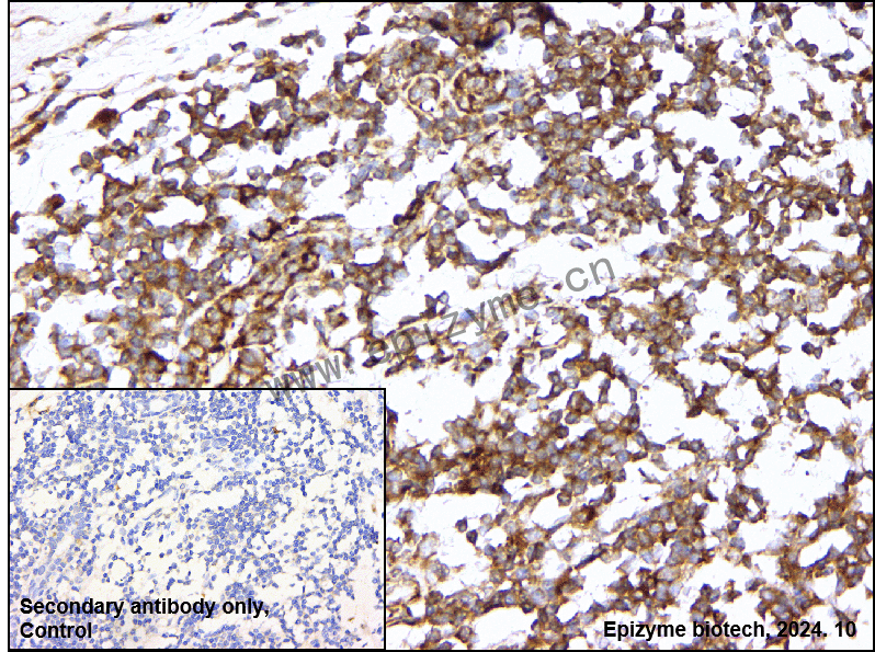 Anti-PUMA Rabbit mAb [95T02C35]