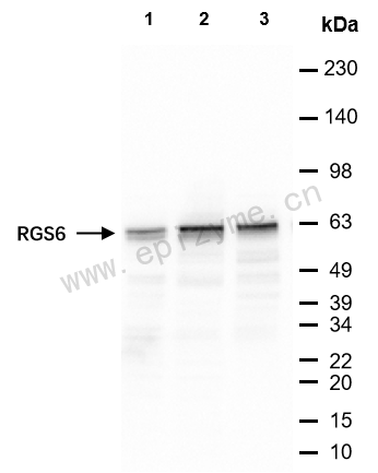 Anti-RGS6 Rabbit mAb [52R48E70]