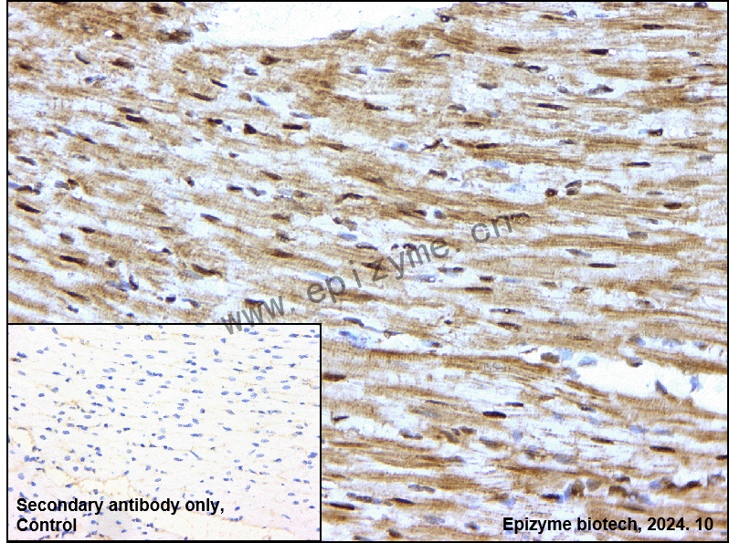 Anti-RGS6 Rabbit mAb [52R48E70]
