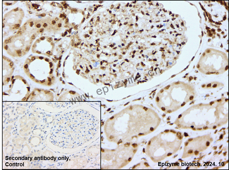 Anti-RGS6 Rabbit mAb [52R48E70]