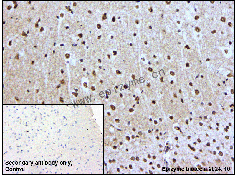 Anti-RGS6 Rabbit mAb [52R48E70]