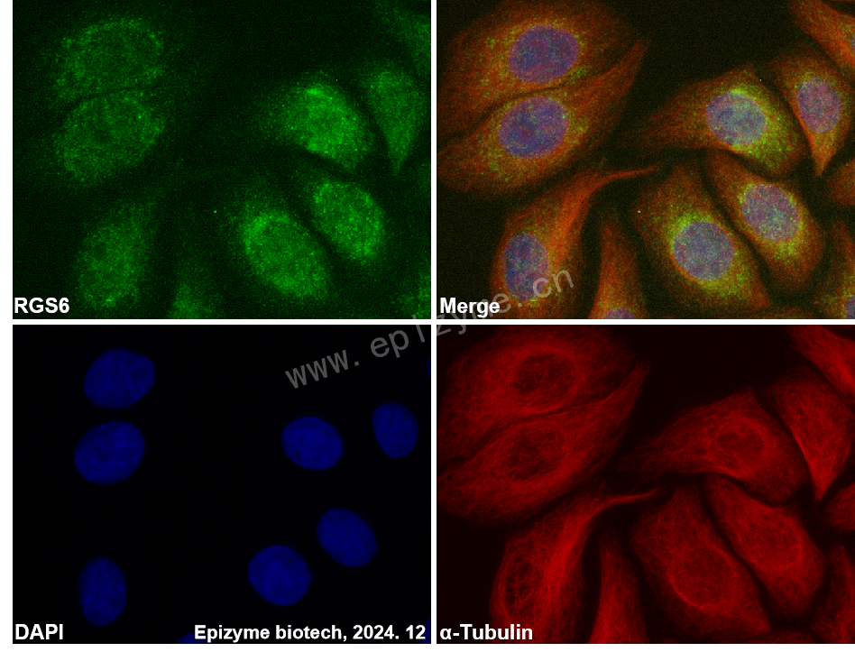 Anti-RGS6 Rabbit mAb [52R48E70]