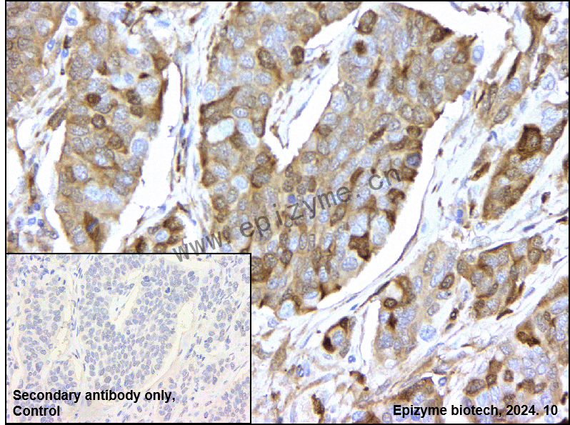 Anti-Stathmin 1 Rabbit mAb [60H89F22]