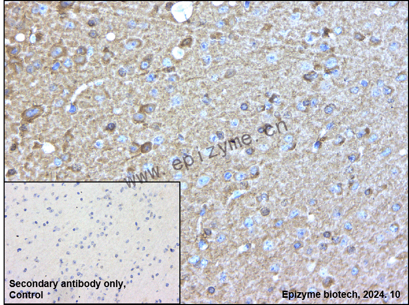 Anti-Stathmin 1 Rabbit mAb [60H89F22]