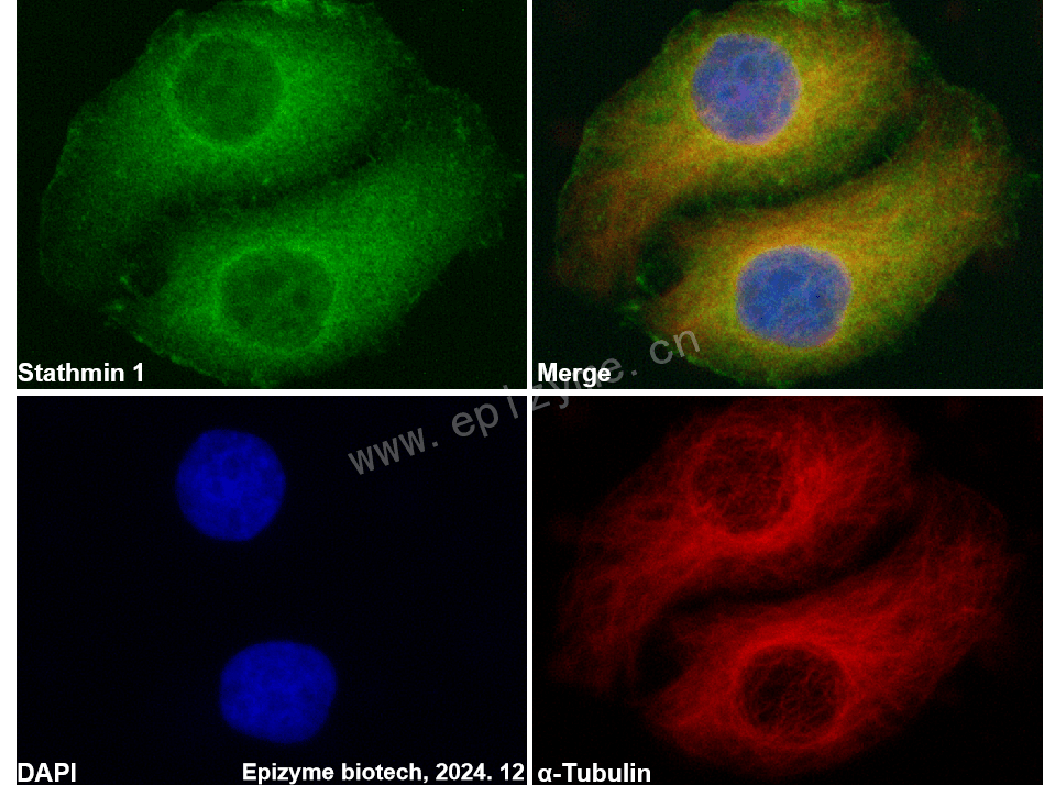 Anti-Stathmin 1 Rabbit mAb [60H89F22]