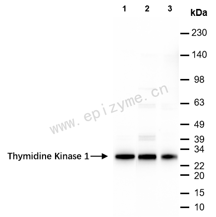 Anti-Thymidine Kinase 1 Rabbit mAb [83Q39S34]