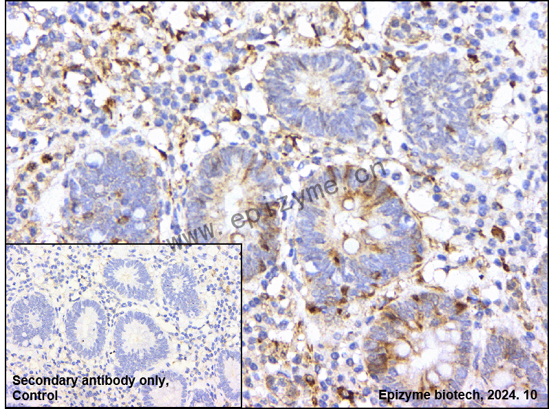 Anti-Thymidine Kinase 1 Rabbit mAb [83Q39S34]