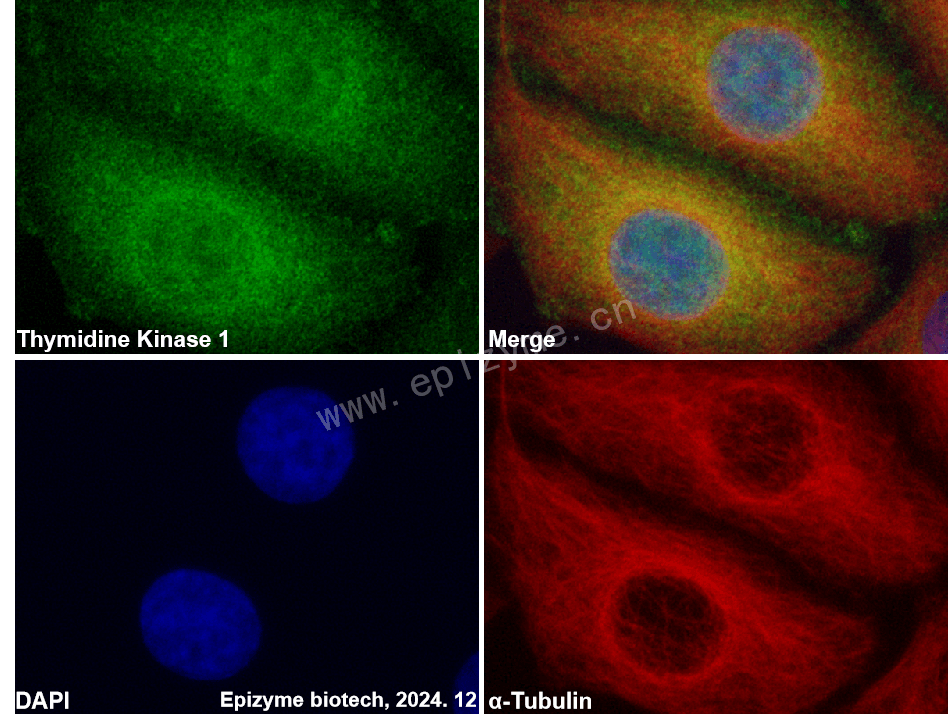 Anti-Thymidine Kinase 1 Rabbit mAb [83Q39S34]