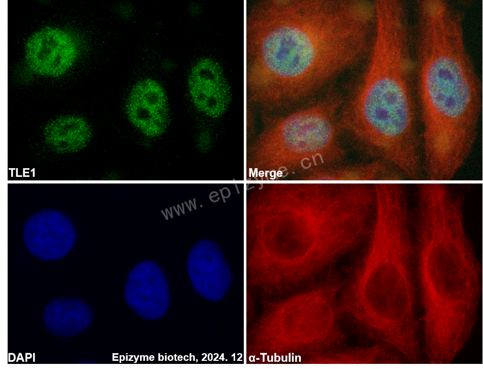 Anti-TLE1 Rabbit mAb [78N82A43]
