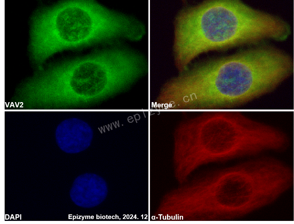 Anti-VAV2 Rabbit mAb [49P01P38]