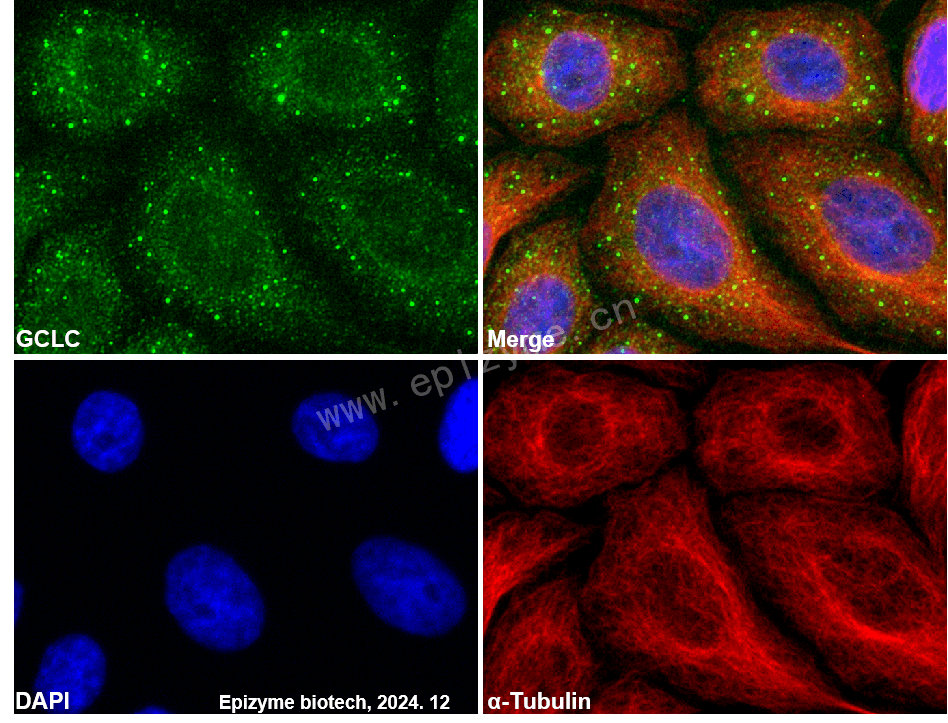 Anti-GCLC Rabbit mAb [59T44H33]