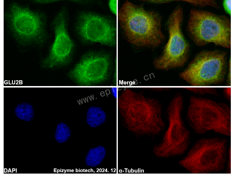 Anti-GLU2B Rabbit mAb [59K41C86]