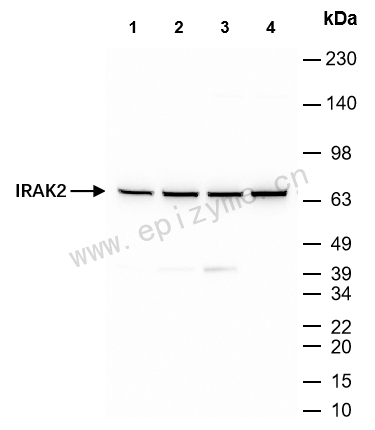 Anti-IRAK2 Rabbit mAb [43B45A46]