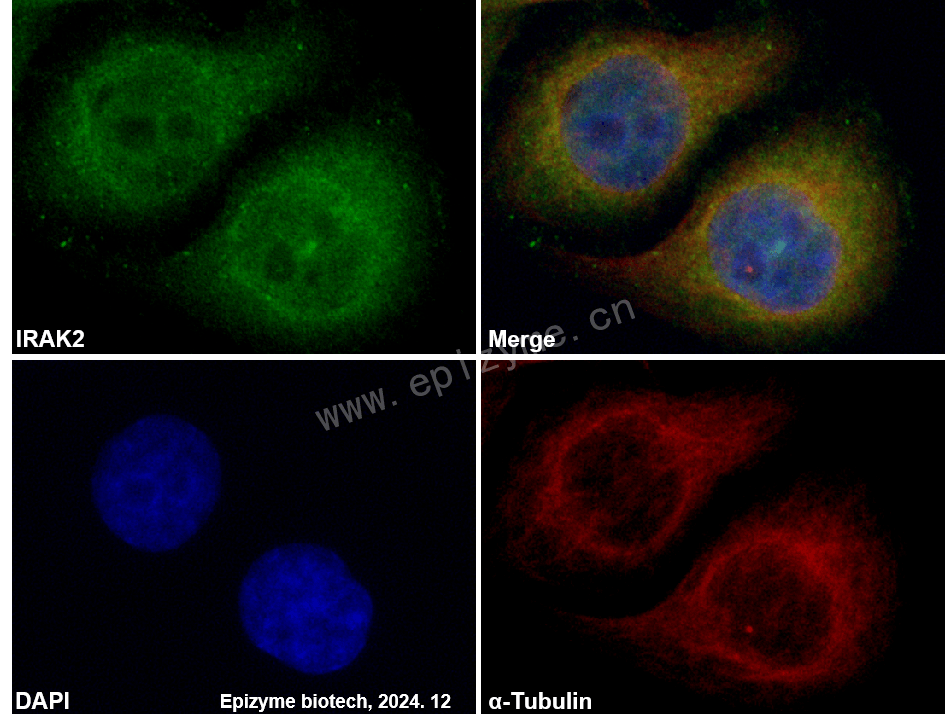 Anti-IRAK2 Rabbit mAb [43B45A46]