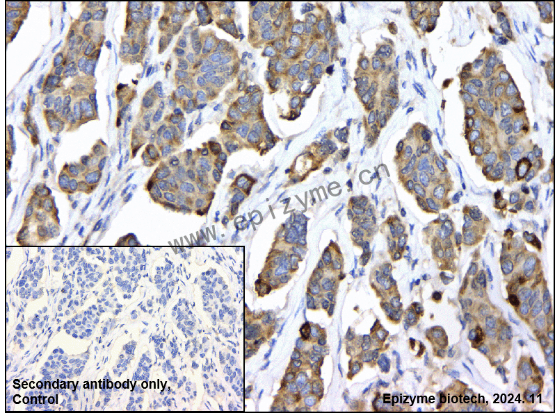 Anti-SOS1 Rabbit mAb [21L91S05]