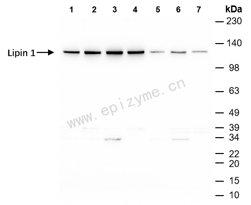 Anti-Lipin 1 Rabbit mAb [77R30G66]