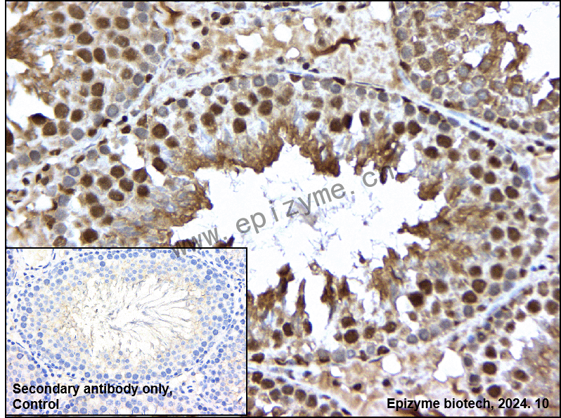 Anti-Lipin 1 Rabbit mAb [77R30G66]