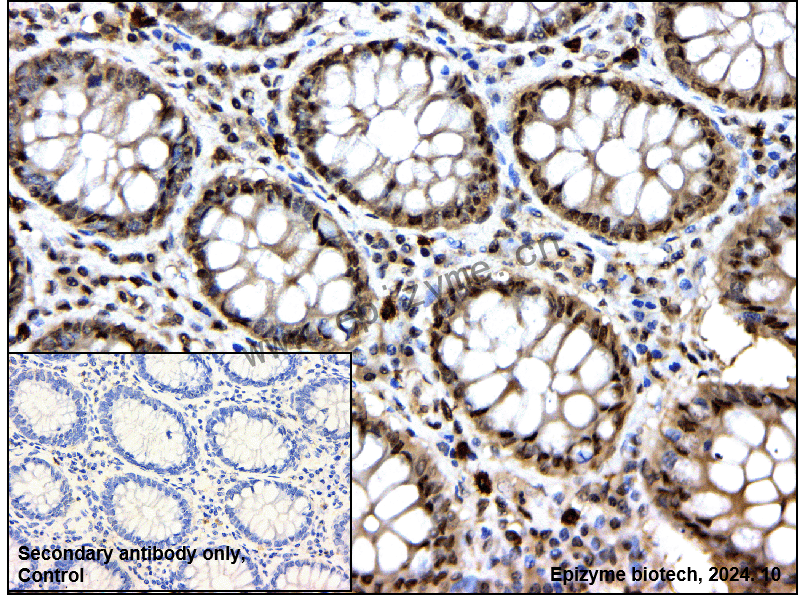 Anti-Lipin 1 Rabbit mAb [77R30G66]