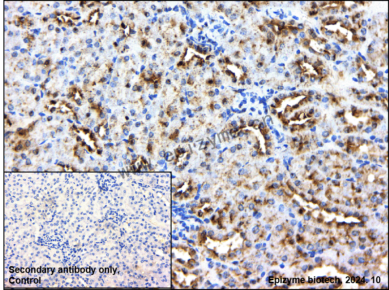 Anti-Lipin 1 Rabbit mAb [77R30G66]