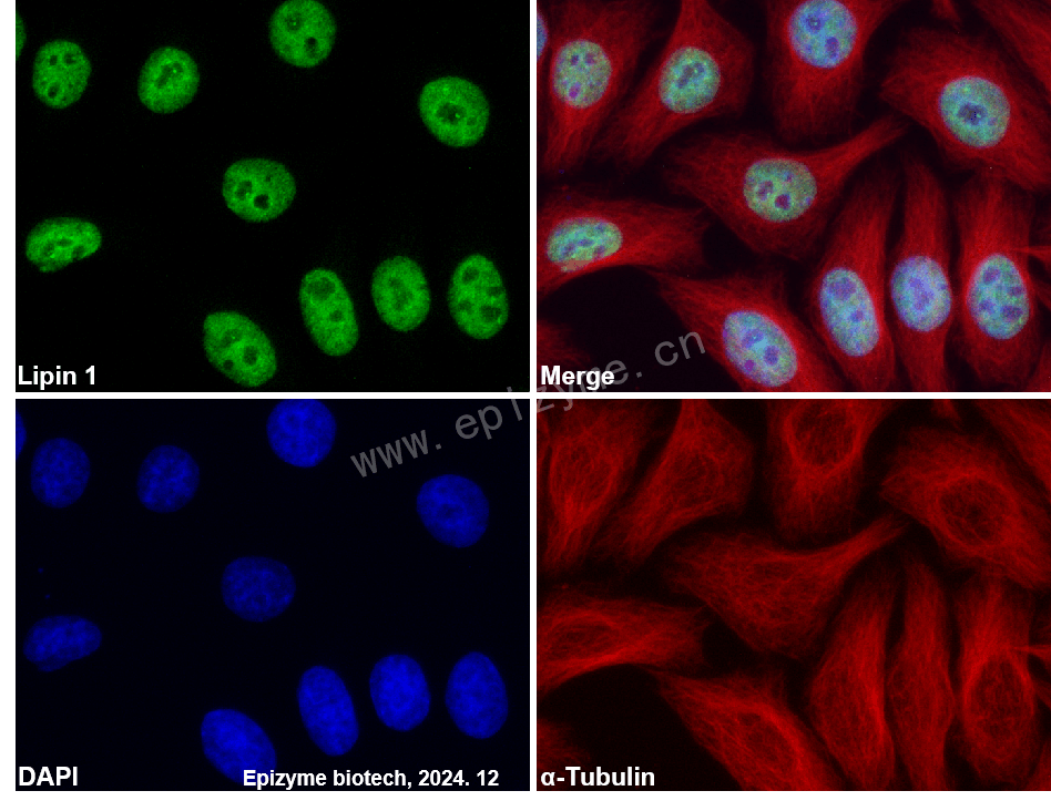 Anti-Lipin 1 Rabbit mAb [77R30G66]