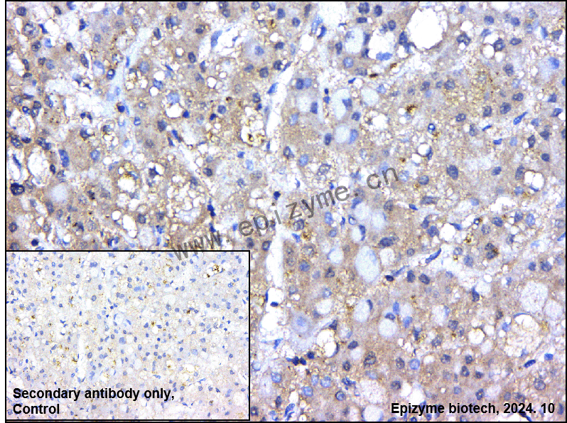 Anti-LIME Rabbit mAb [13Q57L75]