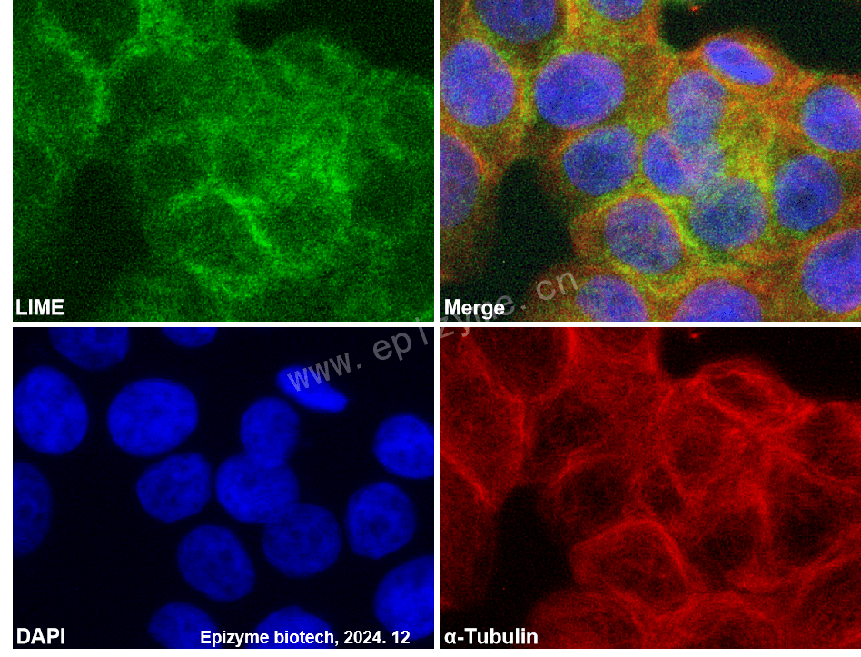 Anti-LIME Rabbit mAb [13Q57L75]