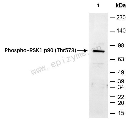 Anti-Phospho-RSK1 p90 (Thr573) Rabbit mAb [32M43J11]