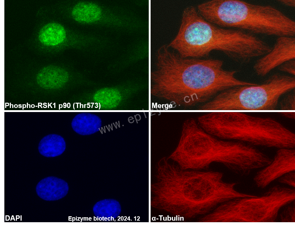 Anti-Phospho-RSK1 p90 (Thr573) Rabbit mAb [32M43J11]