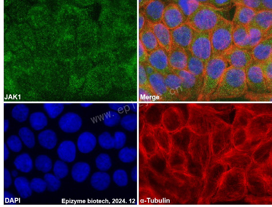 Anti-JAK1 Rabbit mAb [30G06P91]