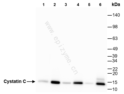 Anti-Cystatin C Rabbit mAb [31C13P16]
