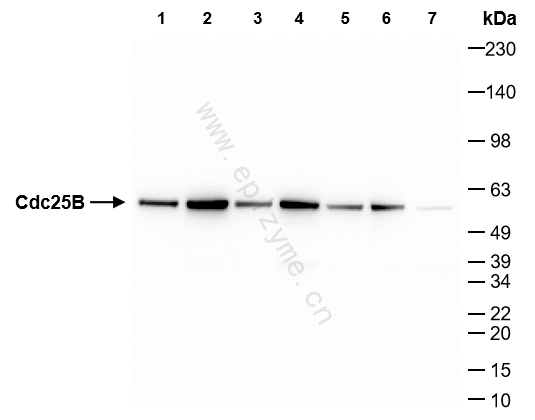 Anti-Cdc25B Rabbit mAb [64M11L48]