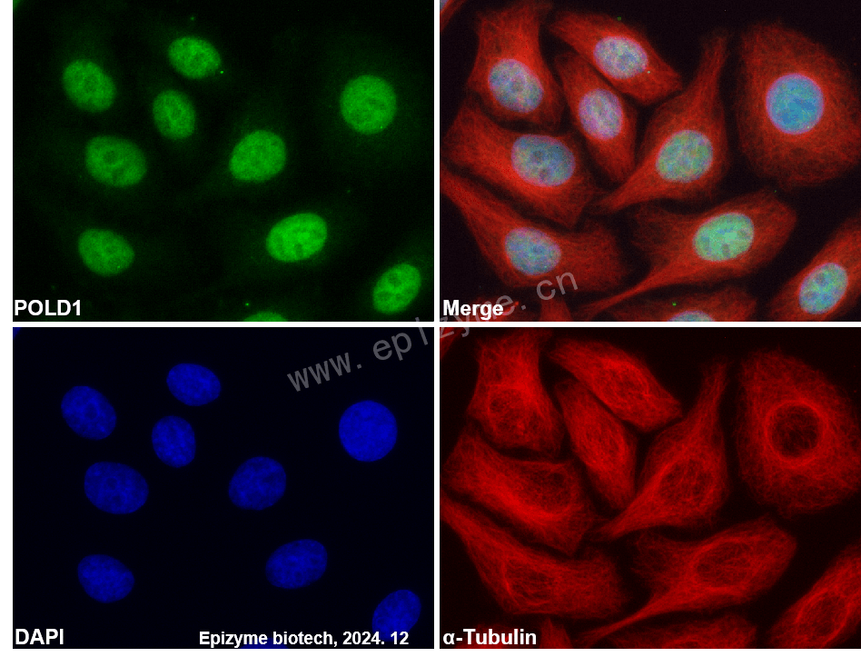 Anti-POLD1 Rabbit mAb [83G86D04]