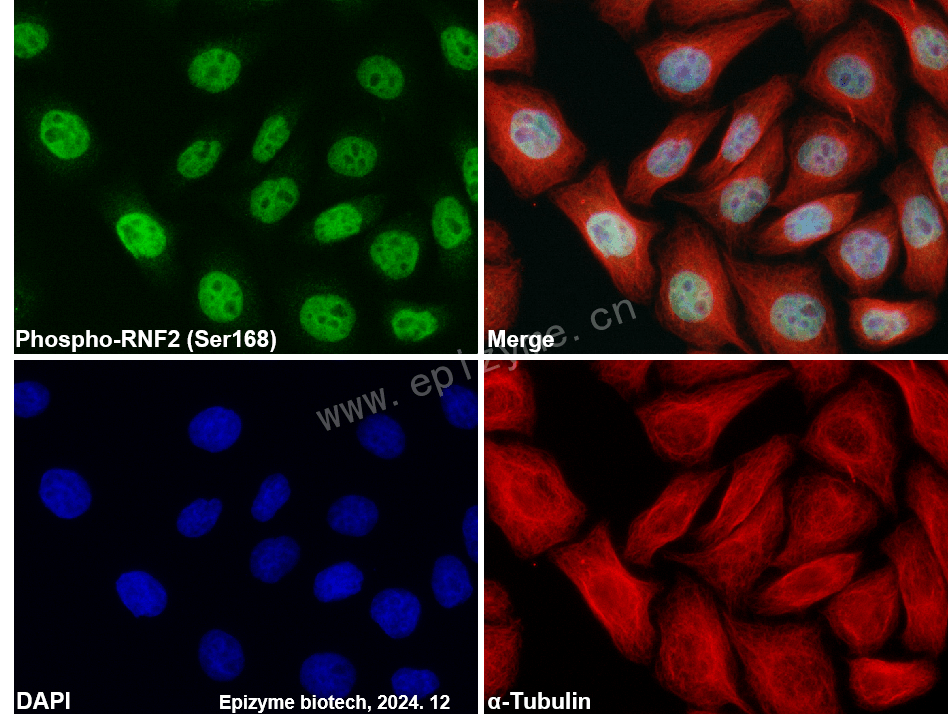 Anti-Phospho-RNF2 (Ser168) Rabbit mAb [55C18A84]