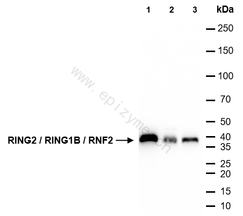 Anti-RING2/RNF2 Rabbit mAb [11K84M20]