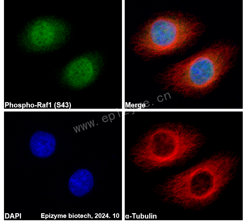Anti-Phospho-Raf1 (Ser43) Rabbit mAb [93M26K31]