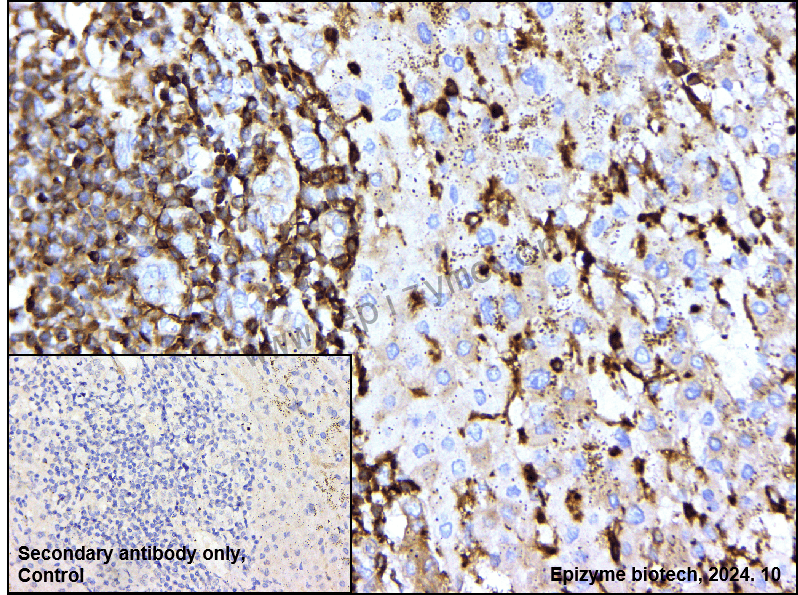 Anti-CAP1 Rabbit mAb [77E00L79]