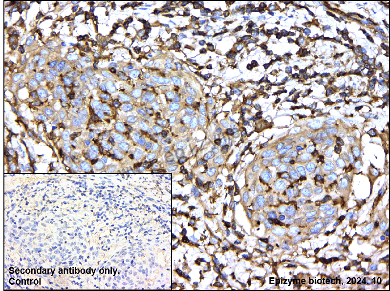 Anti-CAP1 Rabbit mAb [77E00L79]