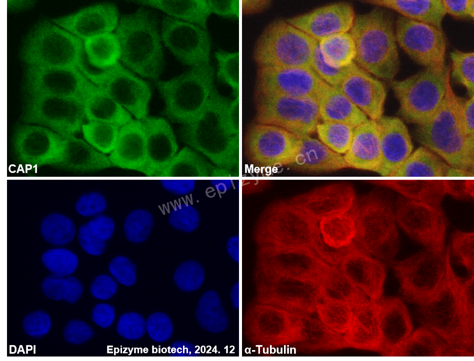 Anti-CAP1 Rabbit mAb [77E00L79]