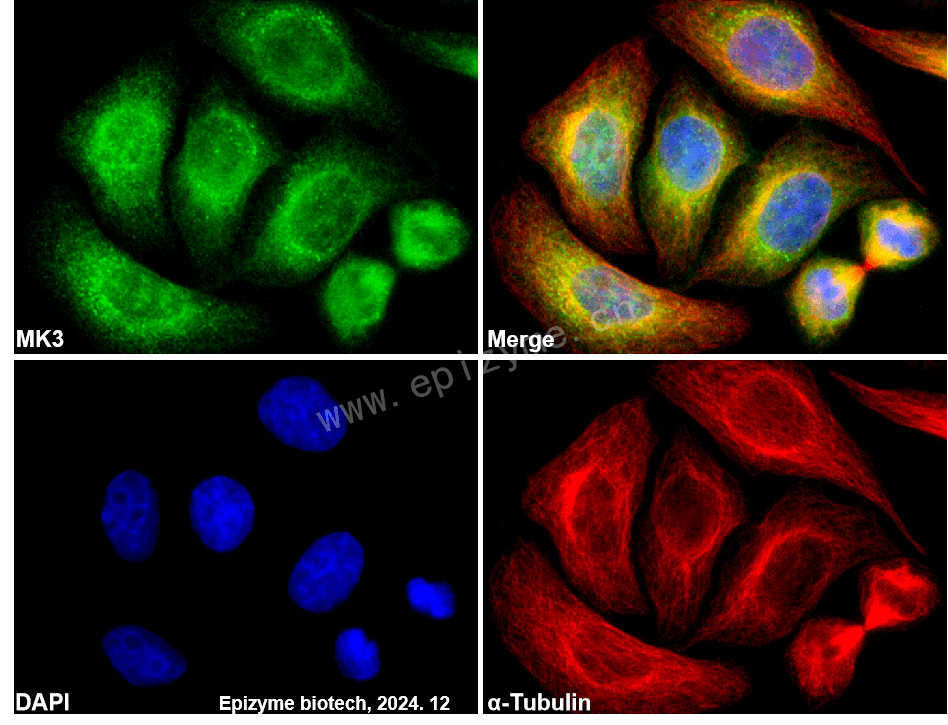 Anti-MK3 Rabbit mAb [47L20Q98]