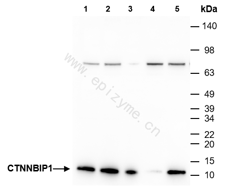 Anti-CTNNBIP1 Rabbit mAb [19E15B02]