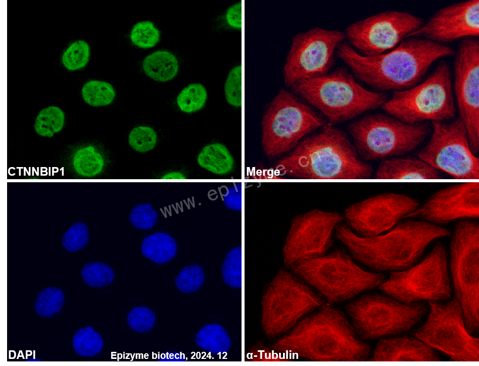 Anti-CTNNBIP1 Rabbit mAb [19E15B02]