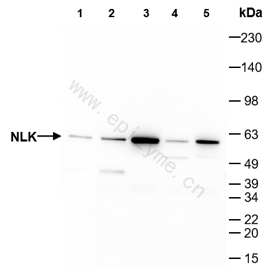 Anti-NLK Rabbit mAb [51G94M39]